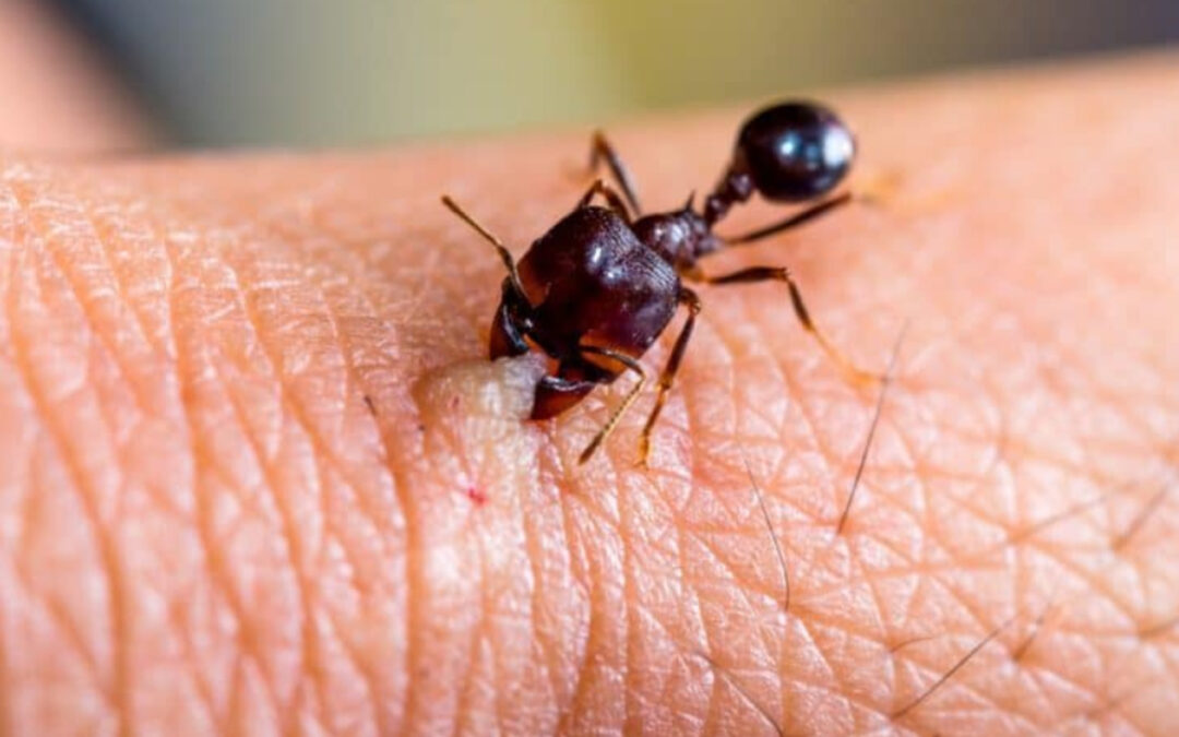 Comment reconnaître et soigner une piqûre de fourmi ?