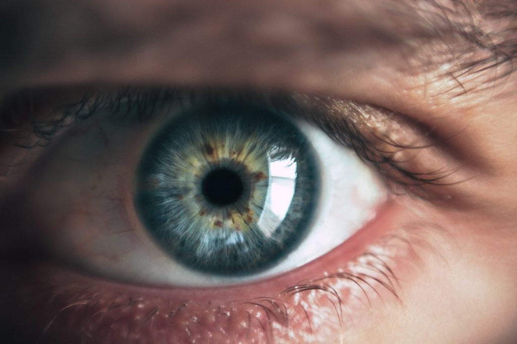 diagnostic de la cataracte